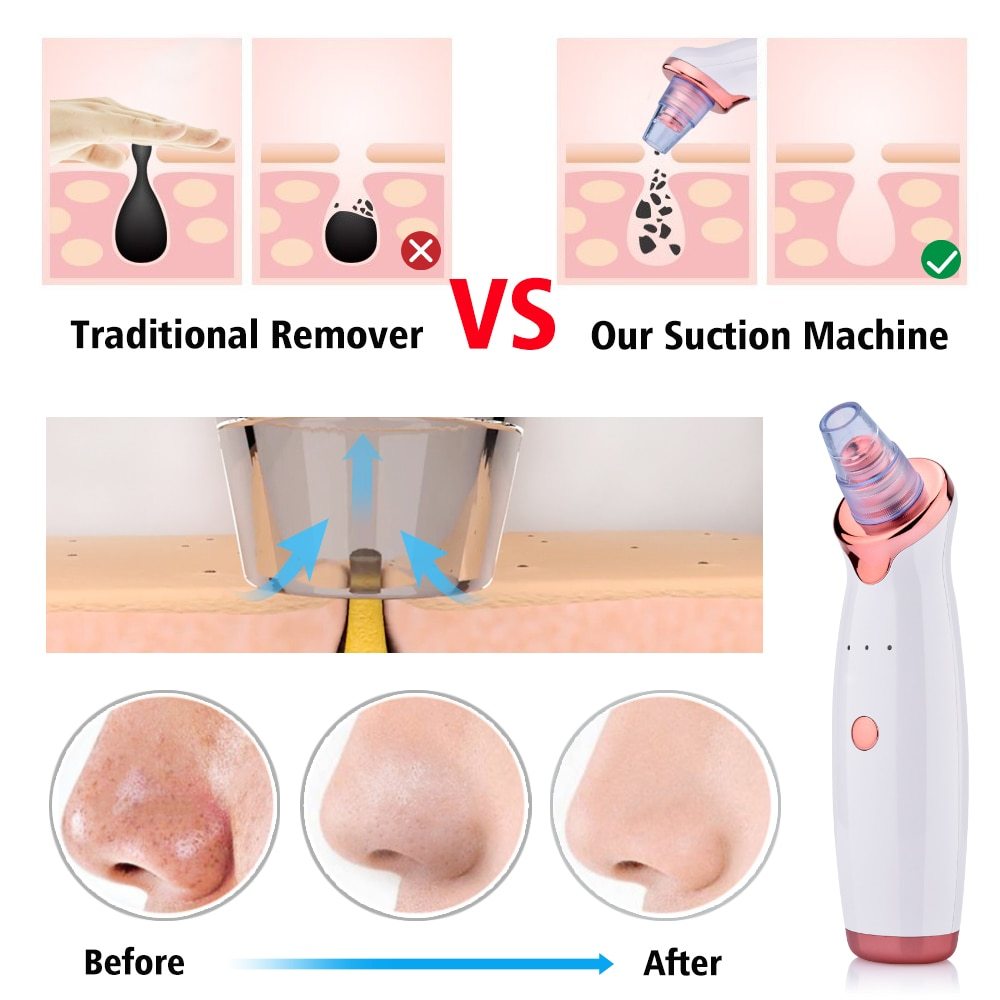 Electric Suction Facial Cleanser